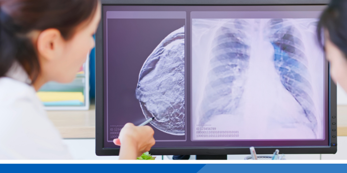 Mammogram and xray image